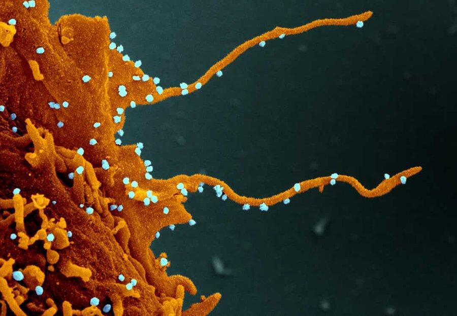 تصاویر خیره کننده از شاخک هایی که ویروس کرونا در سلول ها تشکیل می دهد