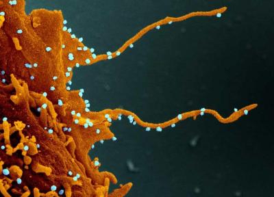 تصاویر خیره کننده از شاخک هایی که ویروس کرونا در سلول ها تشکیل می دهد