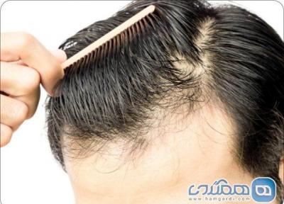 4 راه آنالیز سلامت مو